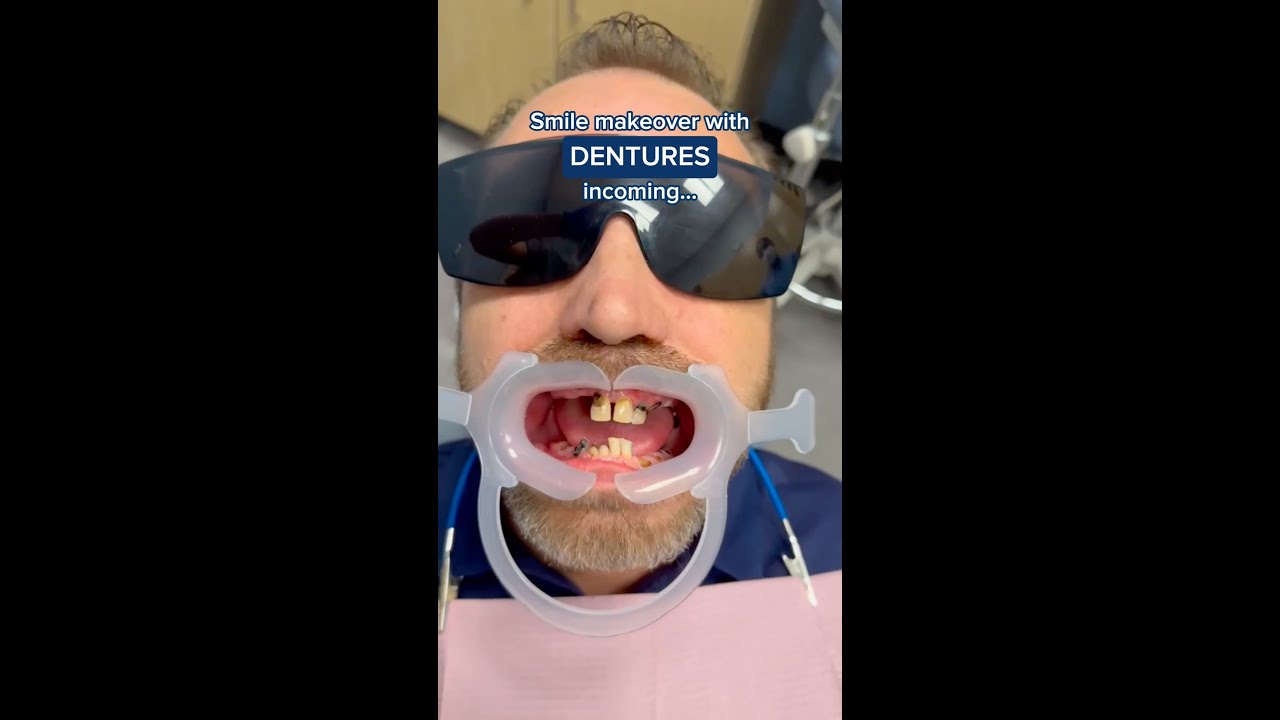 dentadura humana adulta